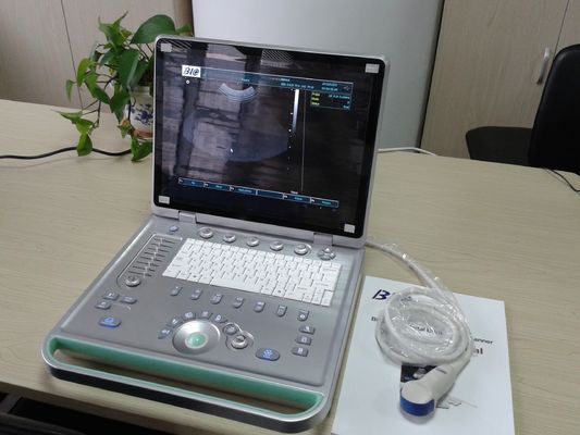 analizzatore portatile di ultrasuono del computer portatile di 3D Digital con tutti i tipi di sonda